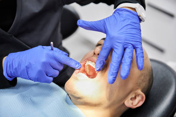 Best Knocked-Out Tooth Emergency  in Frankfort Square, IL